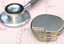 pacemaker quando