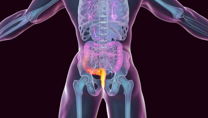 Aumentano i casi di cancro anale vaccino hpv