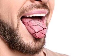 un immagine creata artificialmente con un uomo che espone una lingua screpolata