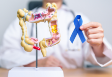 nuova terapia per il tumore metastatico del colon-retto