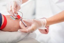 Segnali della sclerosi multipla