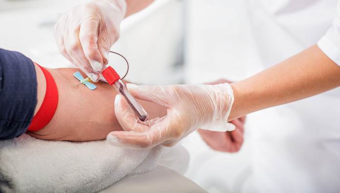 Segnali della sclerosi multipla