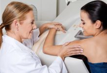 carcinoma lobulare invasivo