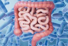 polipi intestinali