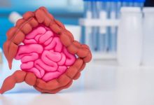 Tumore al colon retto e chemioterapia