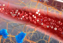 nuovo farmaco anti colesterolo