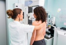 screening mammografico