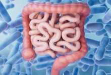 tumore retto senza chirurgia