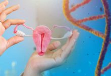 farmaci anti obesità e tumore dell'endometrio