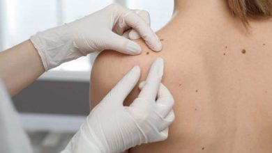 prevenzione del melanoma