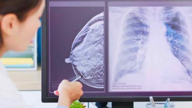un medico visiona gli esami diagnostici di una paziente con tumore al seno