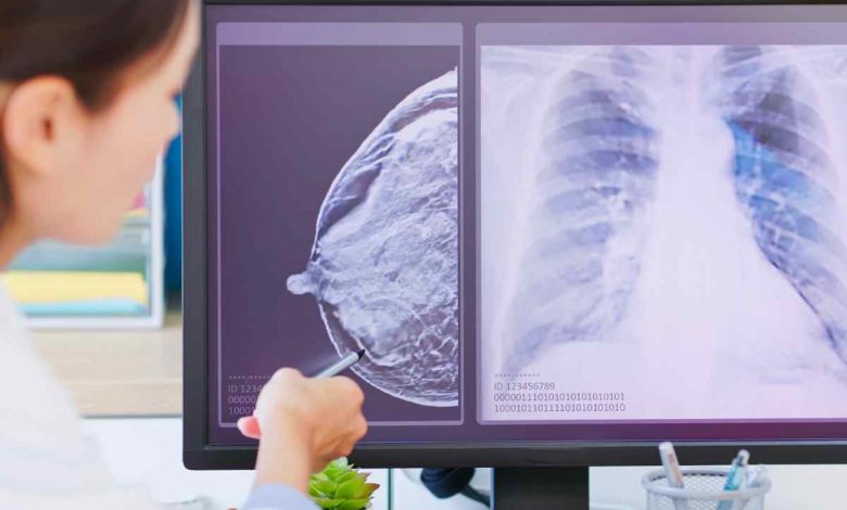 un medico visiona gli esami diagnostici di una paziente con tumore al seno