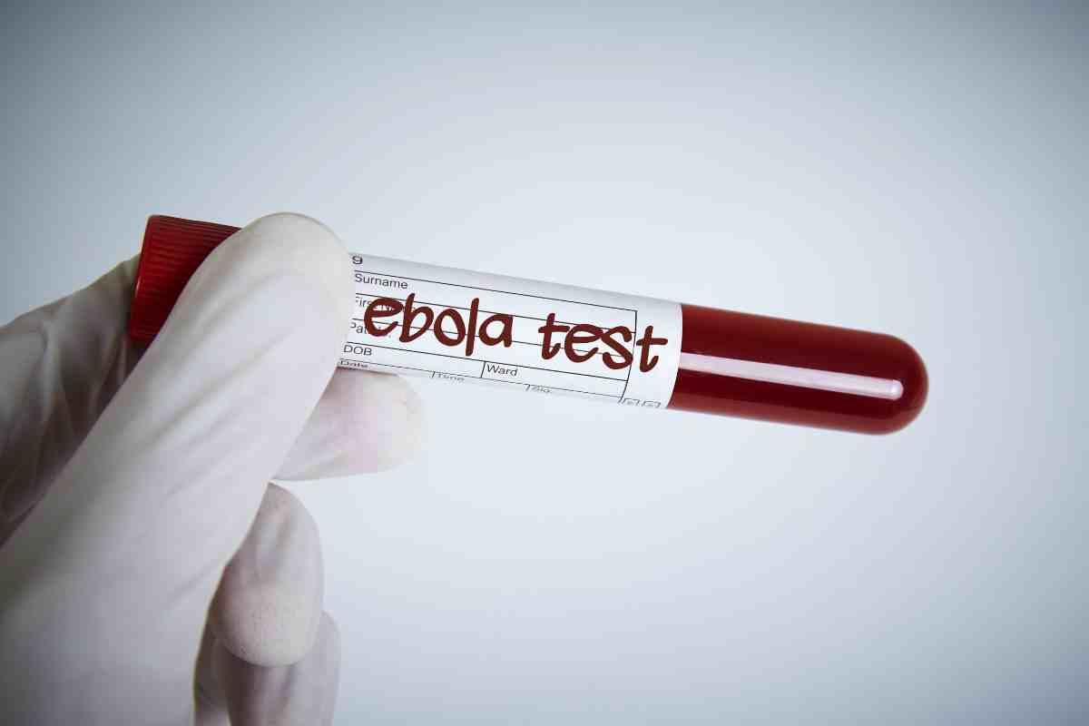 un medico tiene in mano una provetta di sangue per il test di ebola