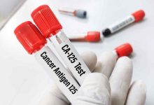 due provette contenenti sangue