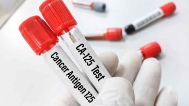 due provette contenenti sangue
