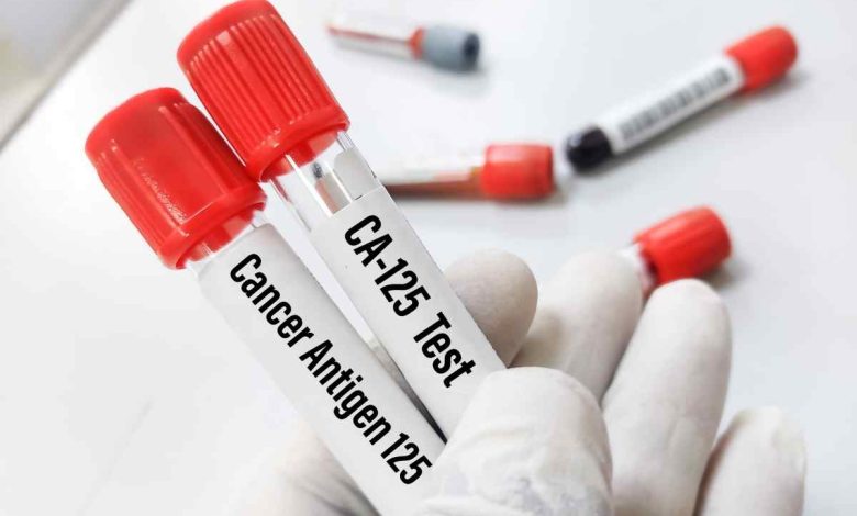due provette contenenti sangue