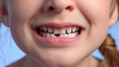 bambina in primo piano con bocca aperta e un dente sotto mancante