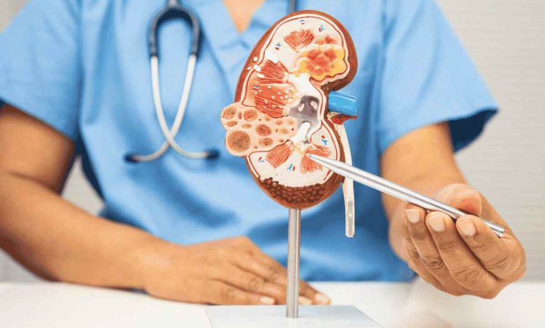 un medico indica un plastico a forma di rene