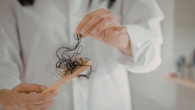 donna che tiene in mano una spazzola con tanti capelli caduti incastrati dentro