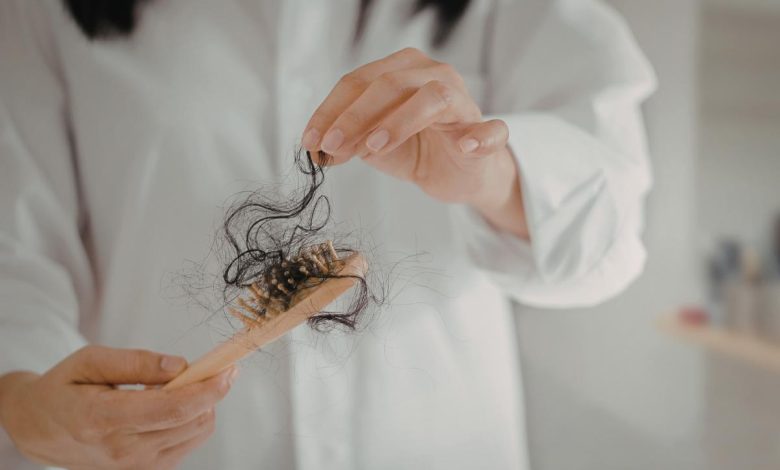 donna che tiene in mano una spazzola con tanti capelli caduti incastrati dentro