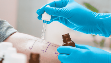 persona che si sottopone a prick test per verificare la presenza di allergie