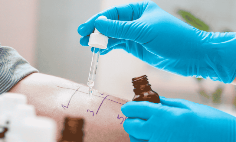 persona che si sottopone a prick test per verificare la presenza di allergie