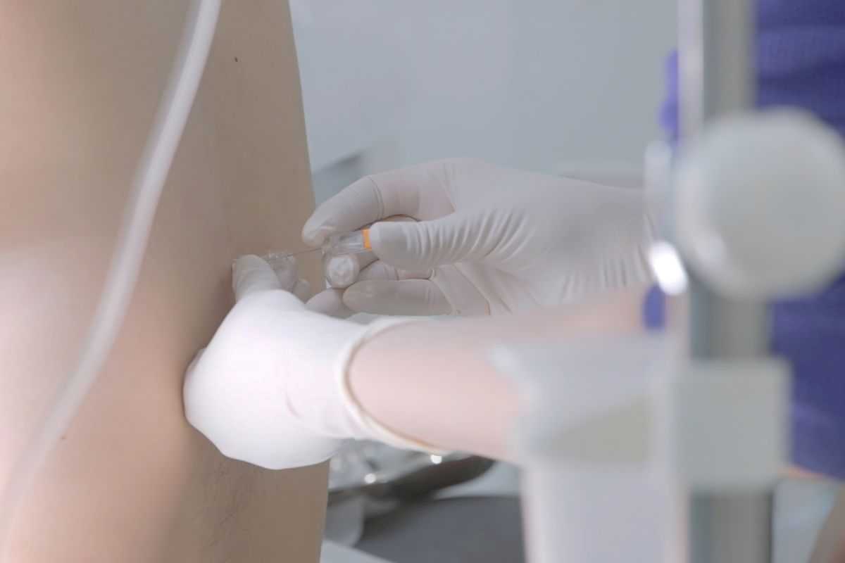 medico esegue puntura lombare (o rachicentesi) per prelievo del liquido cerebrospinale e fare diagnosi di sclerosi multipla