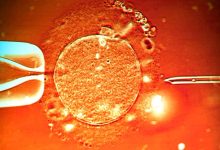 un ovulo al microscopio durante un trattamento di fecondazione artificiale