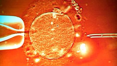 un ovulo al microscopio durante un trattamento di fecondazione artificiale