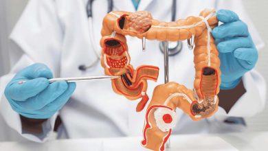 un gastroenterologo mostra un intestino in plastica