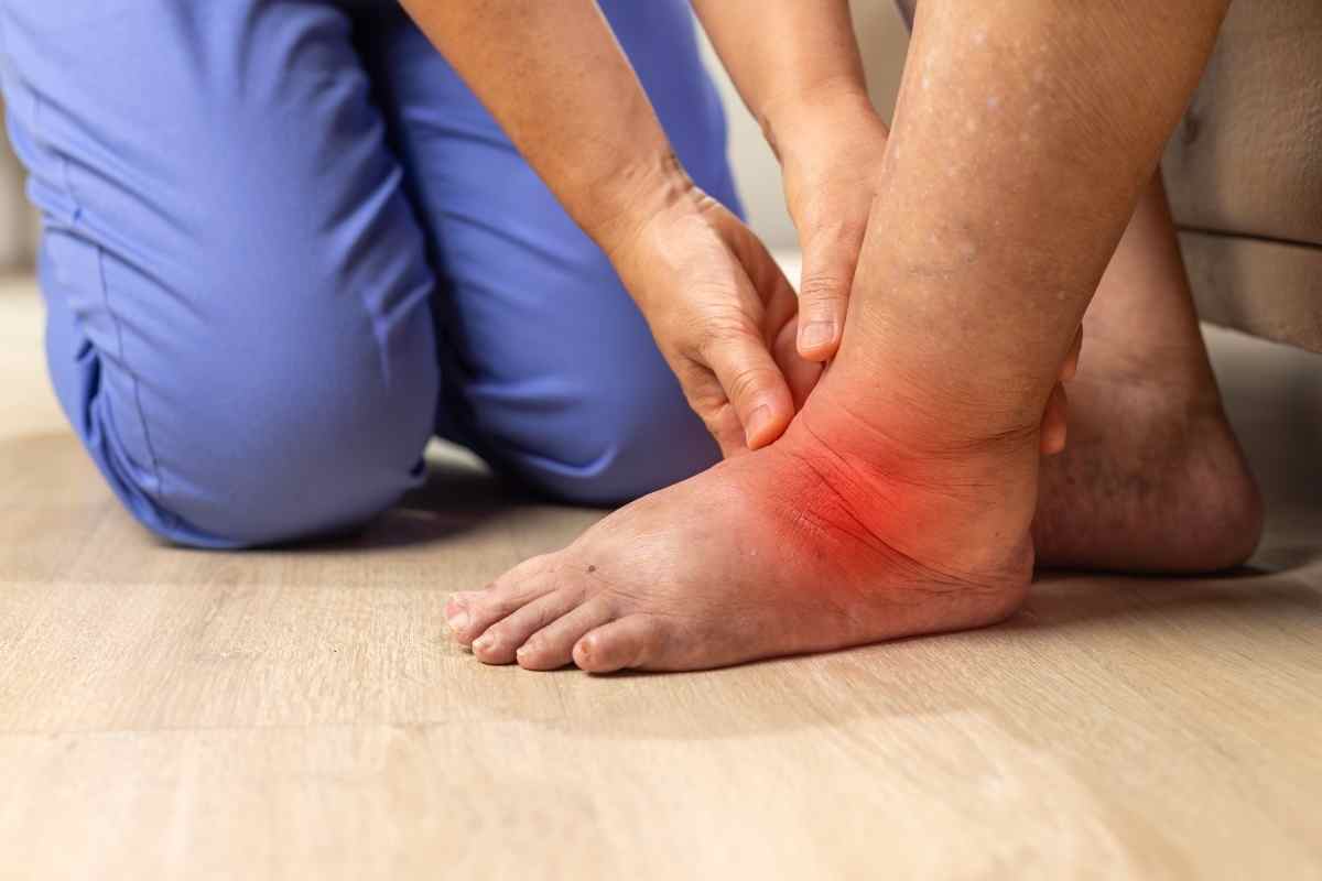 un infermiere controlla la gamba gonfia di una paziente