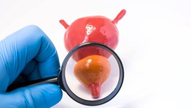 un medico usa la lente di ingrandimento su un modellino che raffigura una vescica