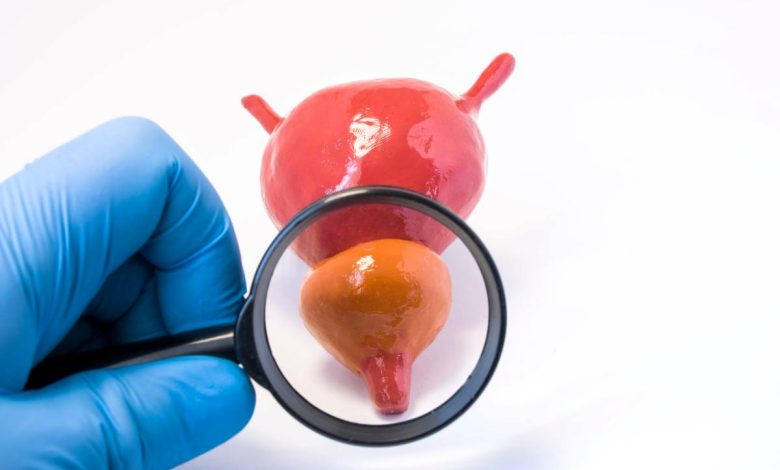 un medico usa la lente di ingrandimento su un modellino che raffigura una vescica