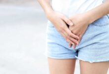 donna al mare che si tocca il pube perché ha una infezione urinaria