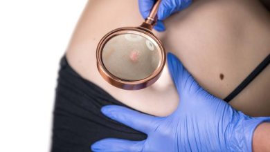 paziente che si sottopone a visita dermatologica per riconoscere un melanoma