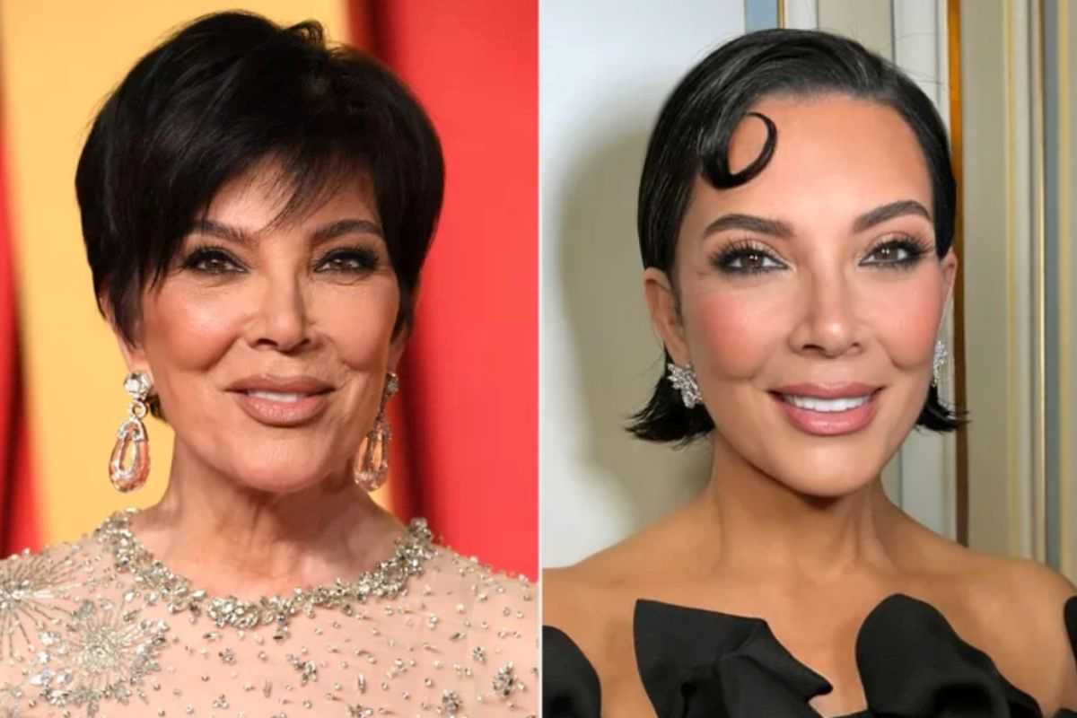 kris jenner prima e dopo l'intervento di ringiovanimento di viso e collo