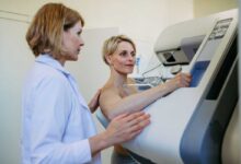 donna che si sottopone a mammografia per screening oncologico