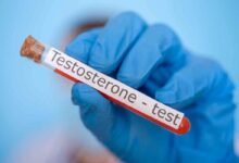 una campione di sangue per verificare i livelli di testosterone