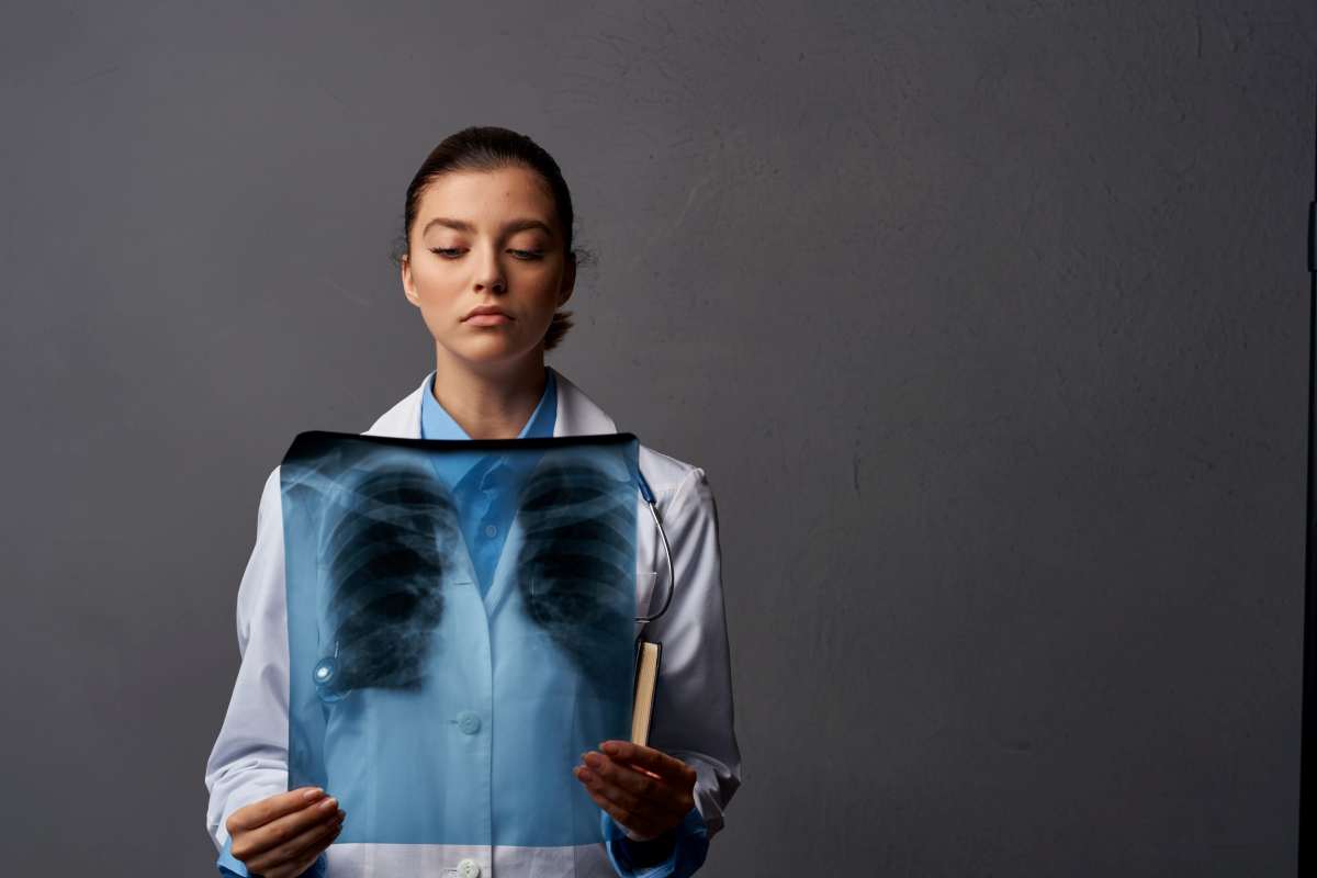 un medico controllo una lastra dei polmoni