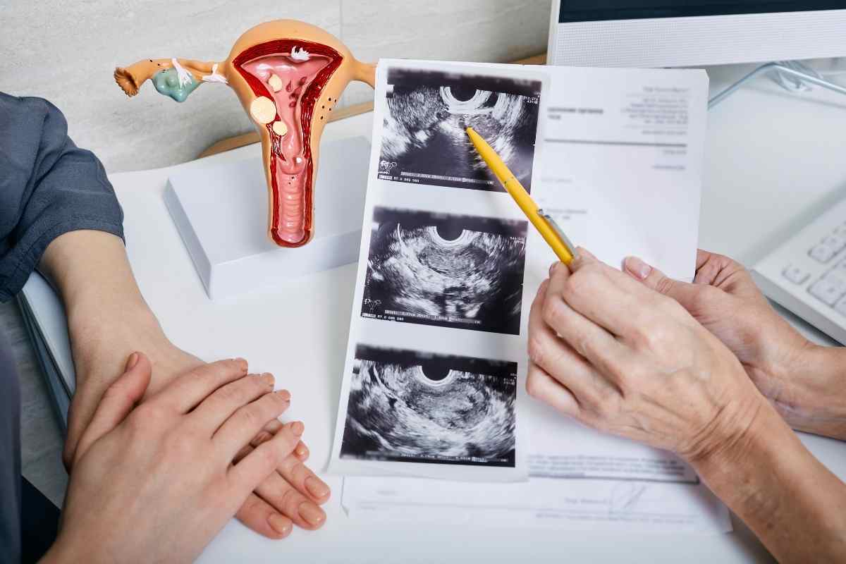 un medico mostra l'ecografia a una paziente