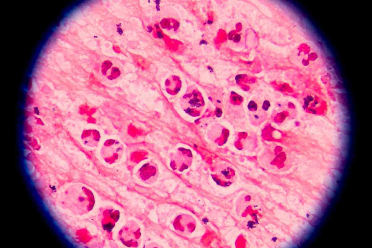 ciclosporiasi al microscopio