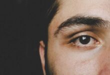 primo piano del viso di un ragazzo con malattia di Stargardt