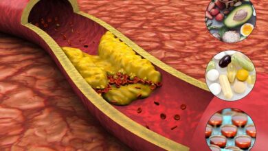 immagine di arteria con colesterolo borderline con affianco immagini di dieta sana, integratori, statine