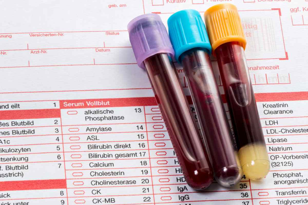 campioni di sangue sui risultati di un esame