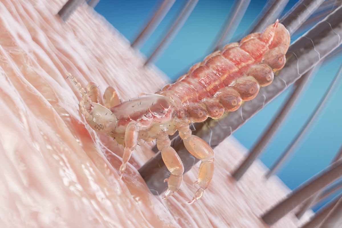 ingrandimento di un pidocchio su un follicolo del capello