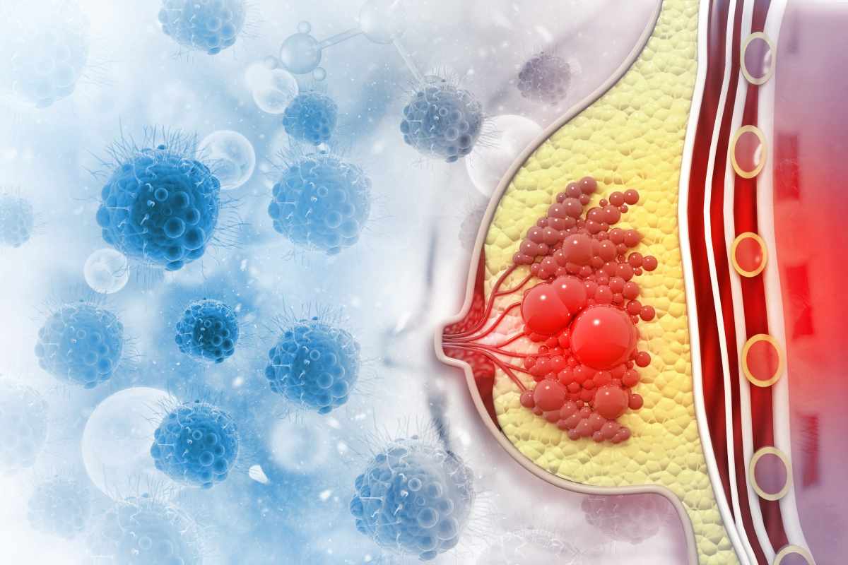 un disegno che mostra l'interno del seno