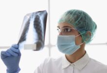 un medico verifica una lastra ai polmoni