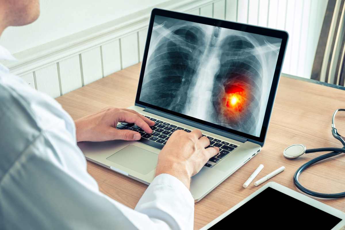 una dottoressa controlla una lastra al computer