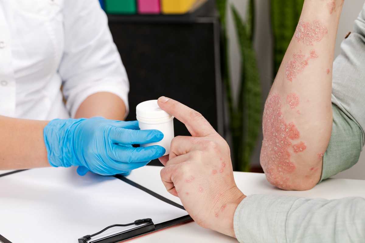 un medico dà la terapia per la psoriasi a un paziente 