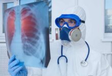 un medico con maschera di protezione analizza una lastra ai polmoni